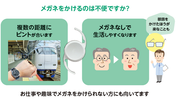 多焦点眼内レンズのメリットを整理しましょう