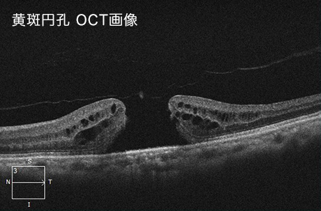 治療