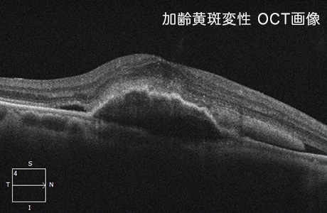 治療(その1)