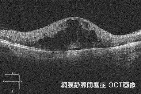 治療(その1)
